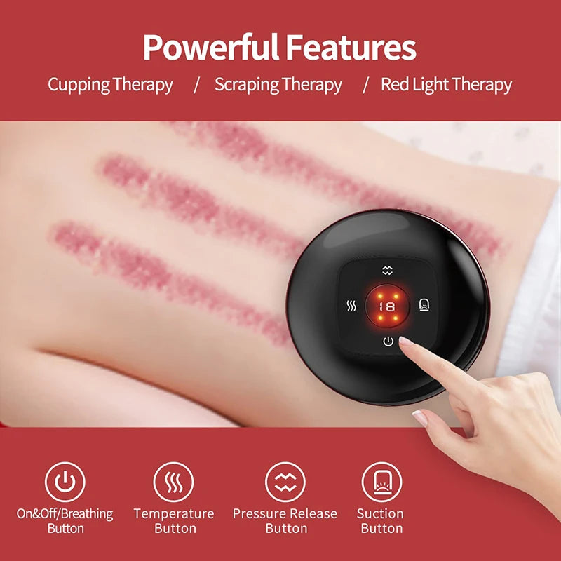 ThermaCup Smart Electric Cupping Device