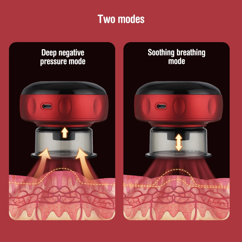 ThermaCup Smart Electric Cupping Device